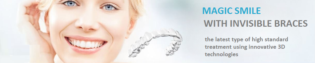 invisible braces